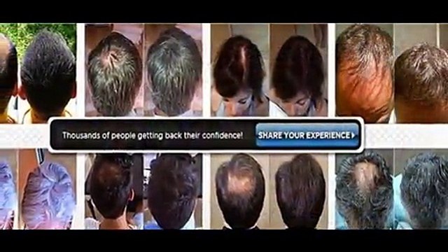 Again Growth Hair Building Fiber Price Buy Call-+91-9953497679