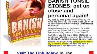 Banish Tonsil Stones Amazon + DISCOUNT + BONUS