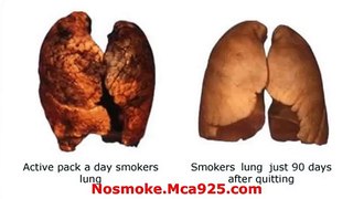 Lung Detoxification-How to Clean Tar,Toxins & Quit Smoking clean lungs