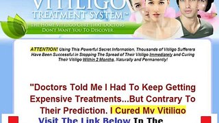 Real & Honest Natural Vitiligo Treatment System Review Bonus + Discount