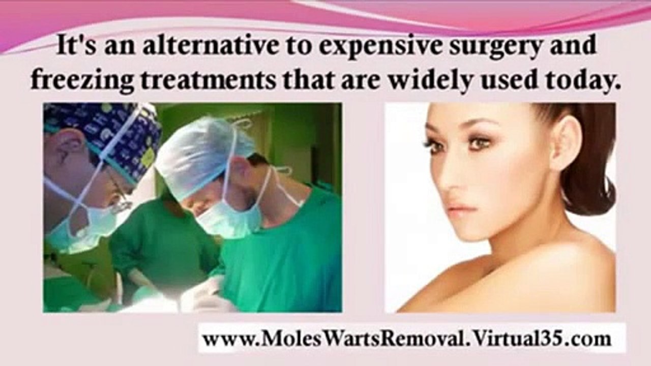 Warts,moles & skin tags removal