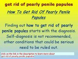 Pearly penile papules Removal toothpaste pearly penile papules removal system