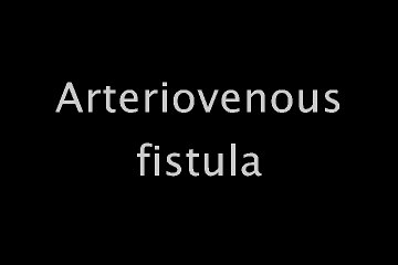 Arteriovenous fistula