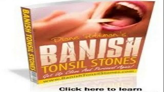 Banish Tonsil Stones Amazon - Banish Tonsil Stones Book