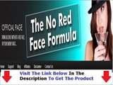 No Red Face Formula FACTS REVEALED Bonus + Discount