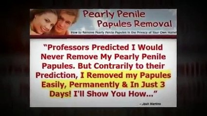 Descargar video: Pearly Penile Papules Removal - Review Of Josh Marvin Pearly Penile Papules Removal System