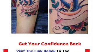 Get Rid Tattoo Unbiased Review Bonus + Discount