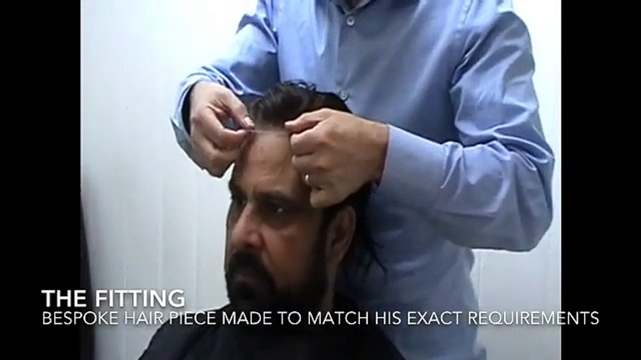 Men's Hair Replacement