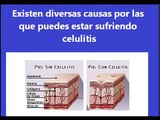Como eliminar la celilitis - Celulitis nunca mas