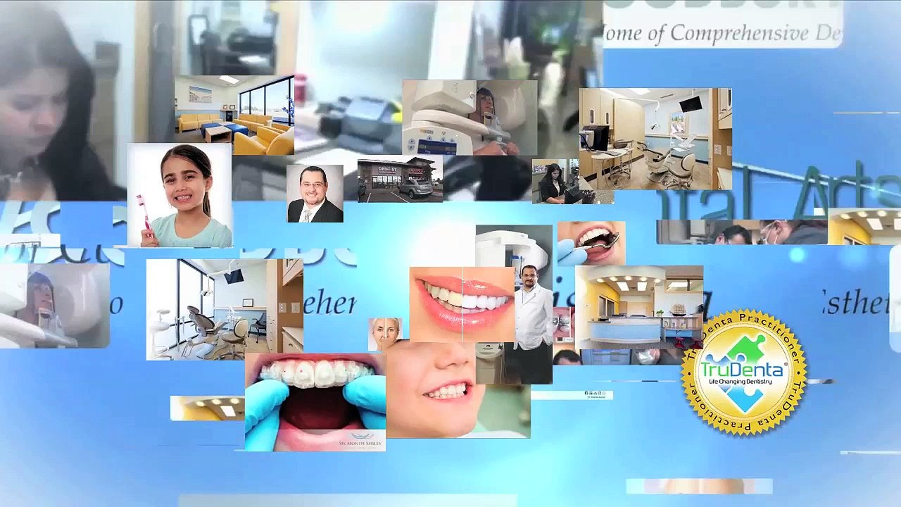 Invisalign in Woodbury, MN  651-436-7559