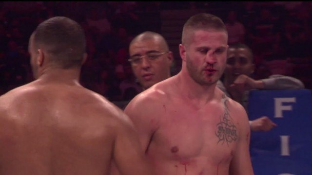 Enorme fracture du nez d'un kick-boxeur