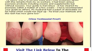 Psoriasis Free For Life Ingredients + DISCOUNT + BONUS