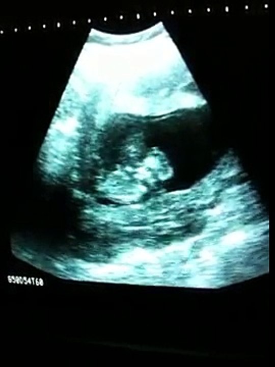 Futuro hiperativo!