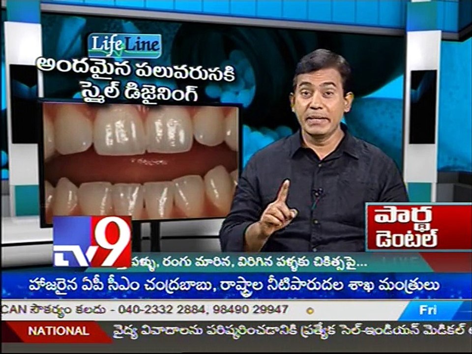 Smile Designing