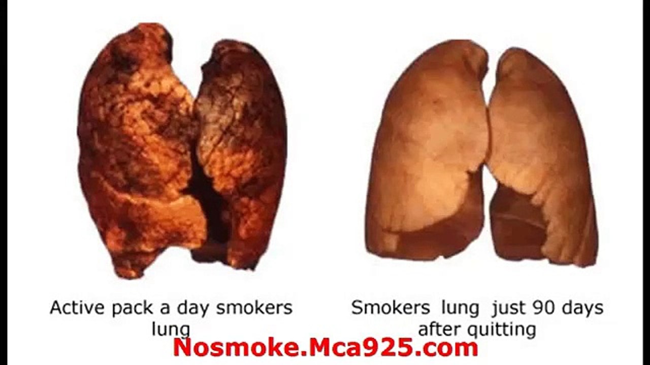 Lung Detoxification-How to Clean Tar,Toxins & Quit Smoking healthy lungs