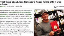 Jose Canseco Admits Finger Never Fell Off