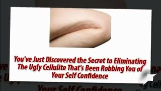 Natural Cellulite Treatment - Cellulite Factor Review