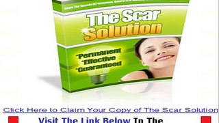Don't Buy The Scar Solution The Scar Solution Review Bonus + Discount