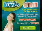 Banish My Bumps Ingredients System