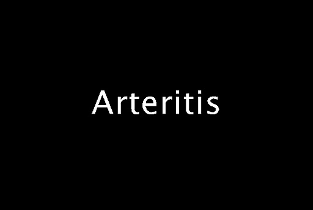 Arteritis