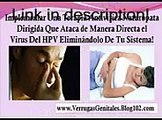 In the event that Curate De Hpv Y Elimina Tus Verrugas Para Siempre! you want