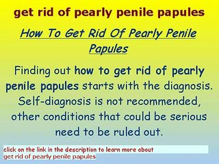 下载视频: Pearly penile papules Removal toothpaste - pearly penile papules removal system