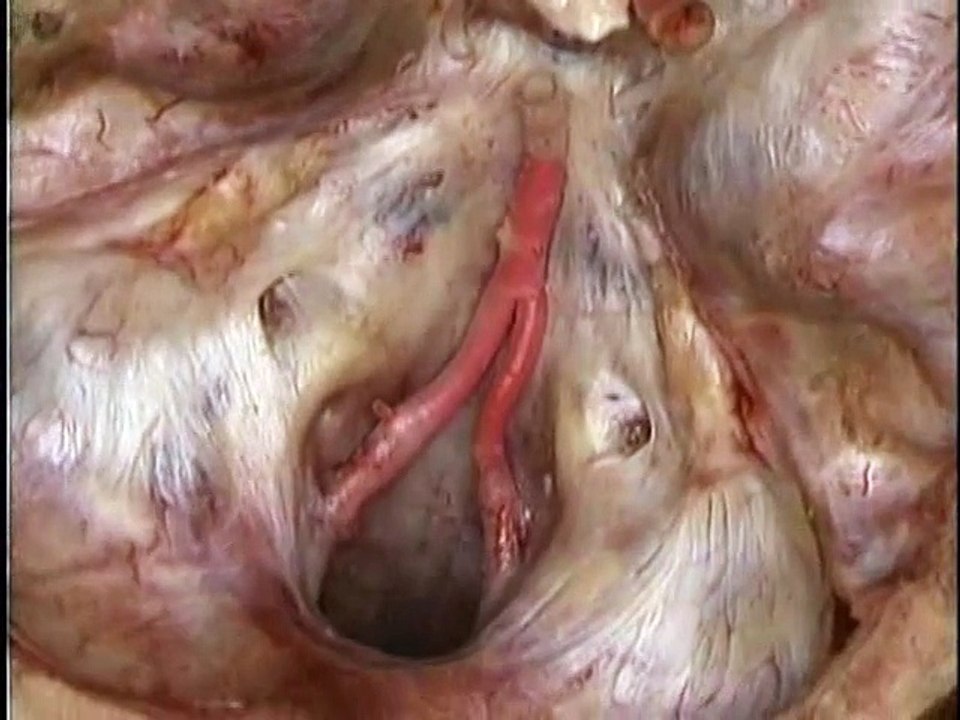 Acland's Video Atlas of Human Anatomy Volume 5: The Head and Neck Part2 The Blood Vessels of the Head and Neck