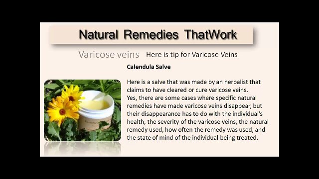 Varicose Veins Treatment Natural using Herbs for Varicose Veins