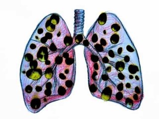 Dia Mundial de Luta Contra o Tabaco | O POVO