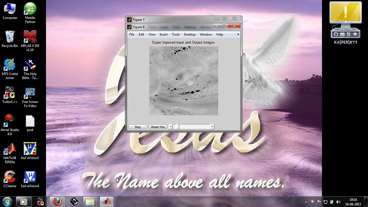 Automated and Interactive Lesion Detection and Segmentation in Uterine Cervix Images