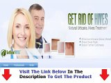 Get Rid Of Hives  Bonus + Discount