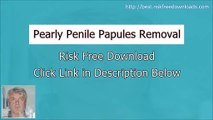 Pearly Penile Papules Removal Free - Pearly Penile Papules Removal Cream