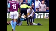 Top 5 Bites Biting Incidents In Football