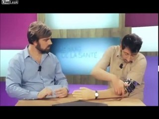 Protez kol sapıtırsa