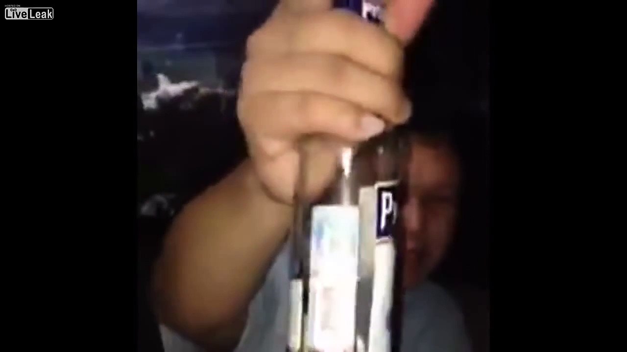 Pro drinker gets burned