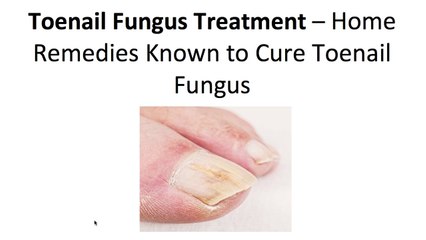 A Home Remedy That Can Cure Toenail Fungus Incredibly Fast...