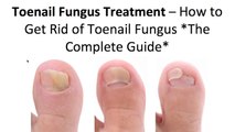 How to Get Rid Of Toenail Fungus Using 3 Simple Home Treatments