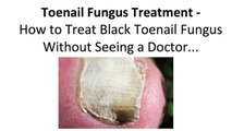Treat Black Toenail Fungus: Fool Proof Toe Fungus Treatments Doctors Don't Want You Knowing About