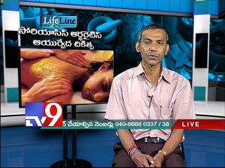 Psoriatic Arthritis treated with Ayurveda