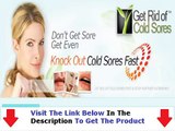 The Get Rid Of Cold Sores Fast Real Get Rid Of Cold Sores Fast Bonus   Discount