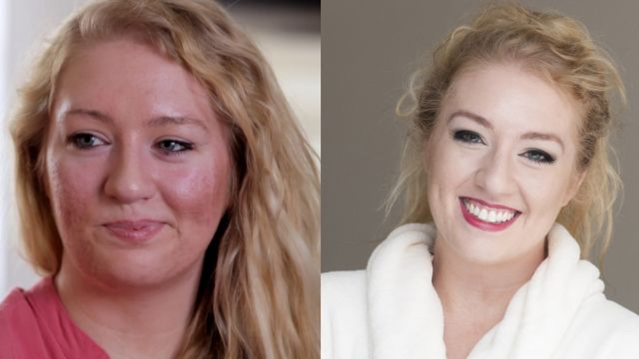 Cassandra To The Rescue  - Ashley's Skin Makeover for Girls' Night Out