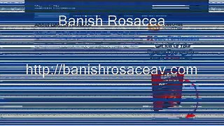 Banish Rosacea
