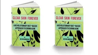dry skin acne treatment - Clear Skin Forever