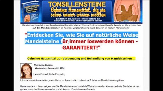 Mandelsteine - Tonsillensteine - Tonsil Stones Remedies