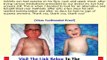 Don't Buy Eczema Free Forever Eczema Free Forever Review Bonus + Discount
