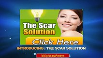 How To Get Rid Of Old Scars - The Scar Solution - Get Rid of Scars Fast