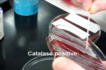 catalase test (shared by athar ali)