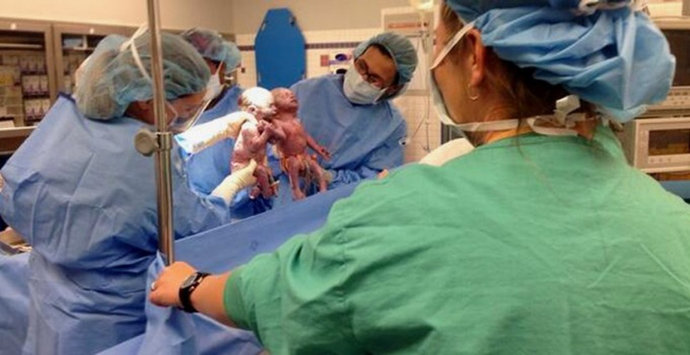 Des jumelles viennent au monde en se tenant la main !