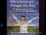 Infecciones Por Hongos No Mas eBook Download