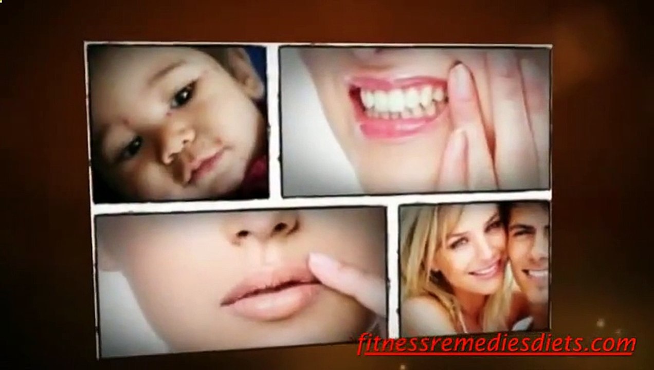 Signs And Symptoms Of Genital Herpes